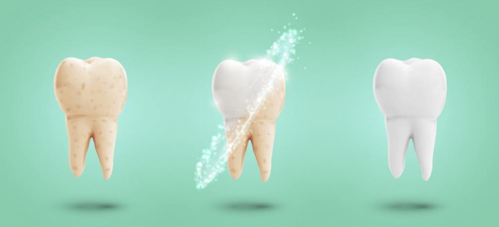 can tooth enamel restore itself tips for restoring damaged tooth enamel 3