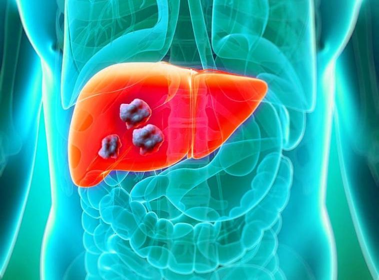 when do hepatitis b symptoms appear and how long do they last 3