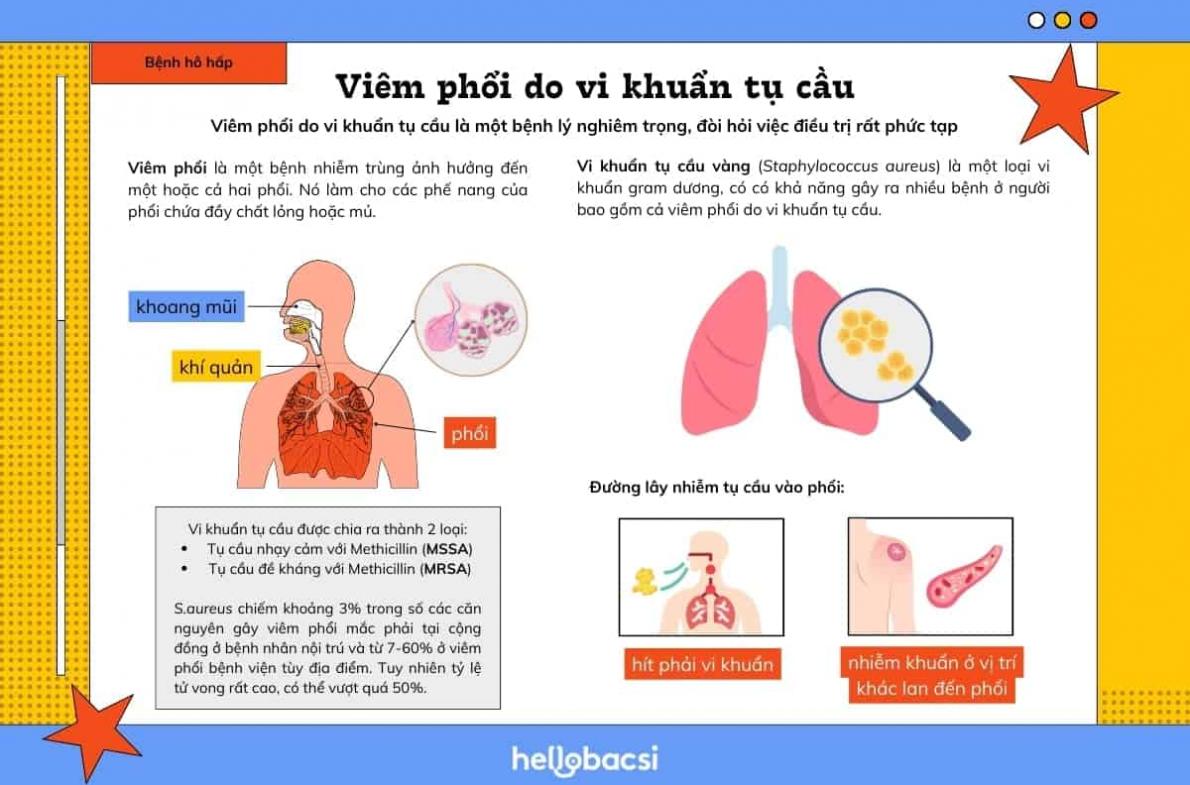 what is staphylococcal pneumonia symptoms causes and treatment 2